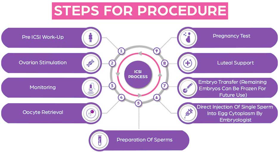 icsi-treatment-in-hyderabad-img02