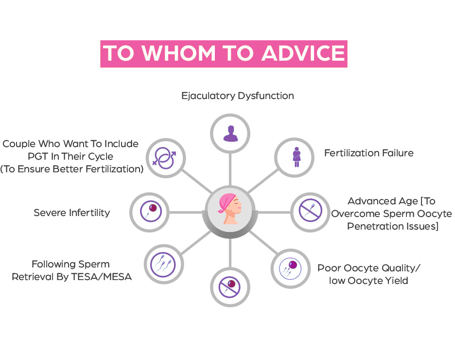 icsi-treatment-in-hyderabad-img1