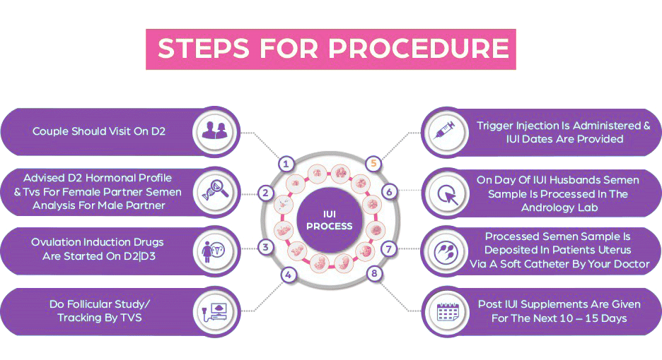 iui-step-by-step-procedure-img
