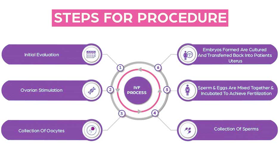 ivf-procedure-step-by-step-img01